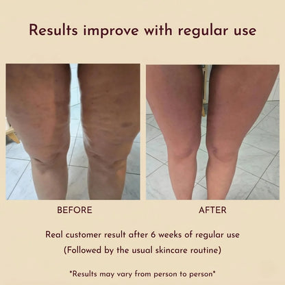 Dress Like Us Anti Cellulite Roller – Body Massager for Smooth & Toned Skin